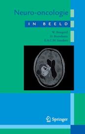 Neuro-oncologie in beeld - W. Boogerd, E.A.C.M. Sanders, D. Brandsma (ISBN 9789031386642)